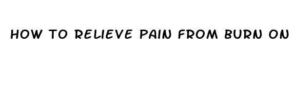 how to relieve pain from burn on hand