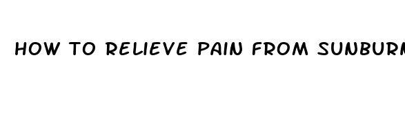 how to relieve pain from sunburn