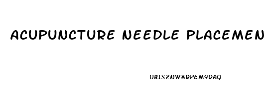 Acupuncture Needle Placement For Erectile Dysfunction