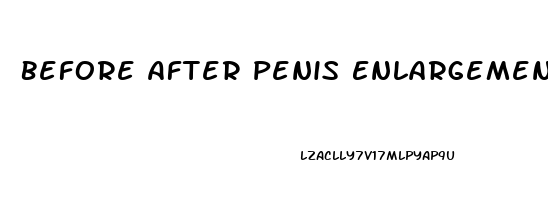 Before After Penis Enlargement