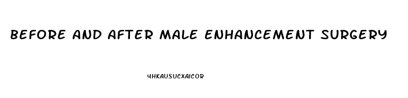 Before And After Male Enhancement Surgery