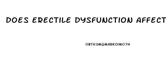 Does Erectile Dysfunction Affect Urination