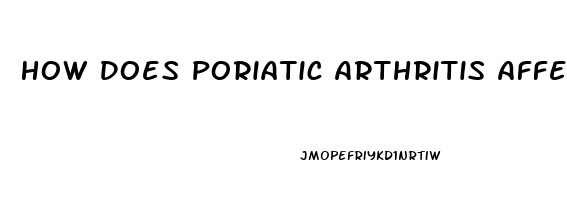 How Does Poriatic Arthritis Affect Sex Drive