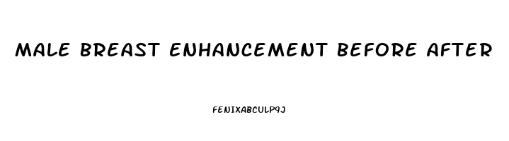 Male Breast Enhancement Before After