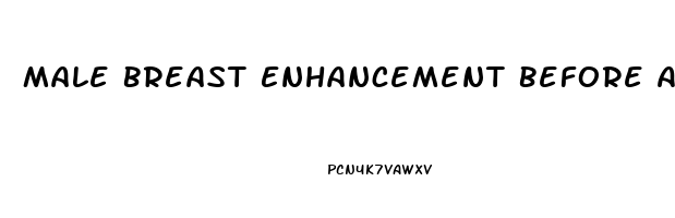 Male Breast Enhancement Before After