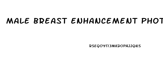 Male Breast Enhancement Photos