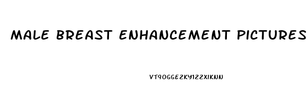 Male Breast Enhancement Pictures