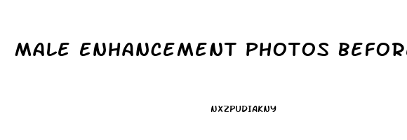 Male Enhancement Photos Before And After