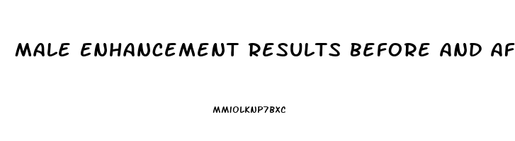 Male Enhancement Results Before And After