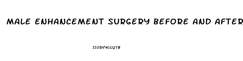 Male Enhancement Surgery Before And After Pictures