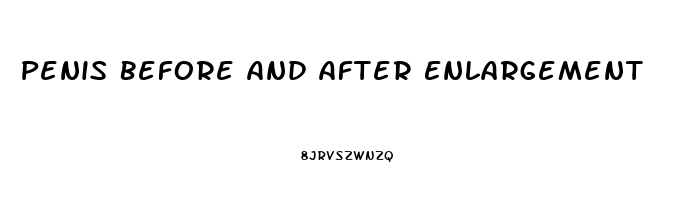 Penis Before And After Enlargement