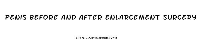 Penis Before And After Enlargement Surgery