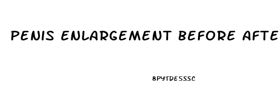 Penis Enlargement Before After