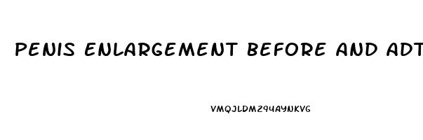 Penis Enlargement Before And Adter