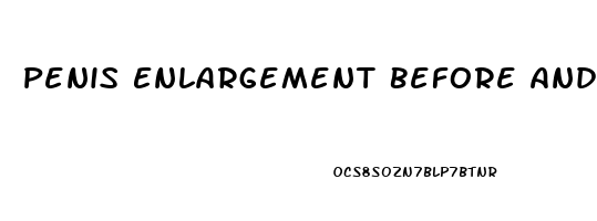 Penis Enlargement Before And After