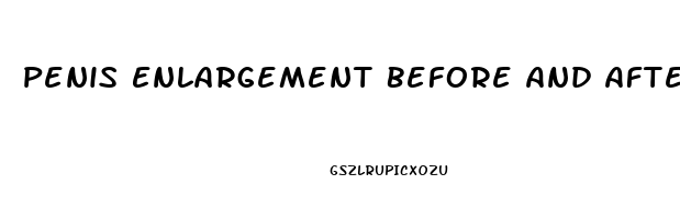 Penis Enlargement Before And After Erect