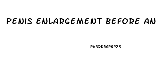 Penis Enlargement Before And After Erect