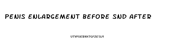 Penis Enlargement Before Snd After