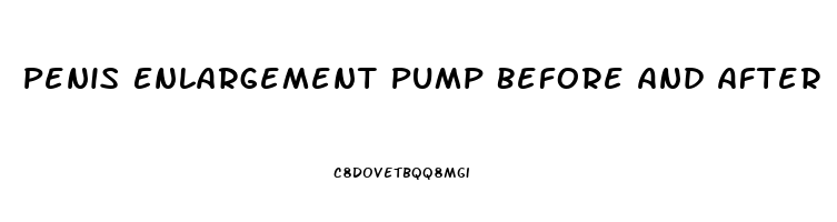 Penis Enlargement Pump Before And After