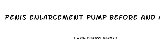 Penis Enlargement Pump Before And After