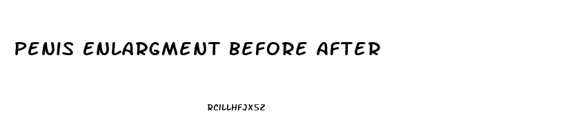 Penis Enlargment Before After