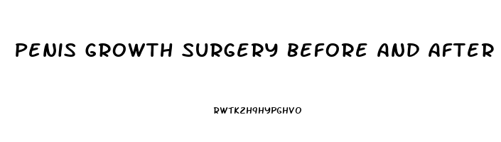 Penis Growth Surgery Before And After