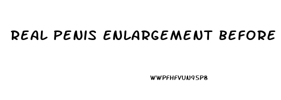 Real Penis Enlargement Before And After