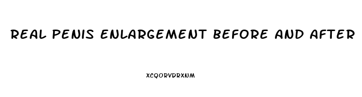 Real Penis Enlargement Before And After