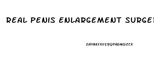 Real Penis Enlargement Surgery
