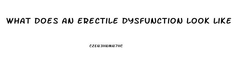 What Does An Erectile Dysfunction Look Like