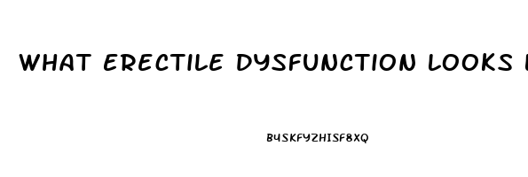 What Erectile Dysfunction Looks Like