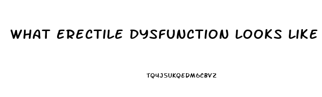 What Erectile Dysfunction Looks Like