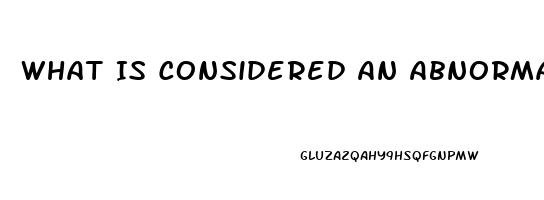 What Is Considered An Abnormal Sex Drive For Men