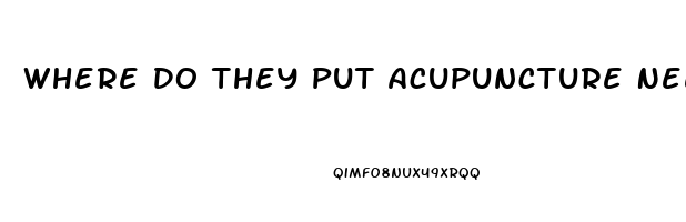 Where Do They Put Acupuncture Needles For Erectile Dysfunction