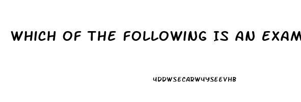 Which Of The Following Is An Example Of A Sexual Dysfunction