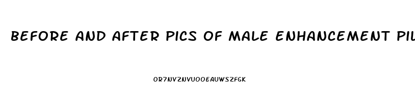 before and after pics of male enhancement pills