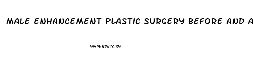 male enhancement plastic surgery before and after