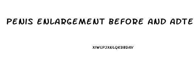 penis enlargement before and adter