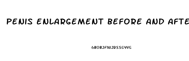 penis enlargement before and after