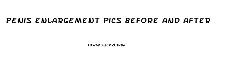 penis enlargement pics before and after