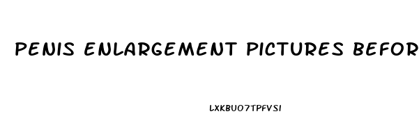 penis enlargement pictures before and after