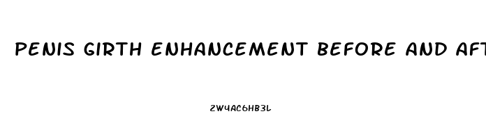 penis girth enhancement before and after