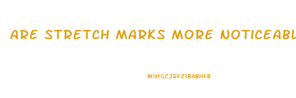 are stretch marks more noticeable when you lose weight