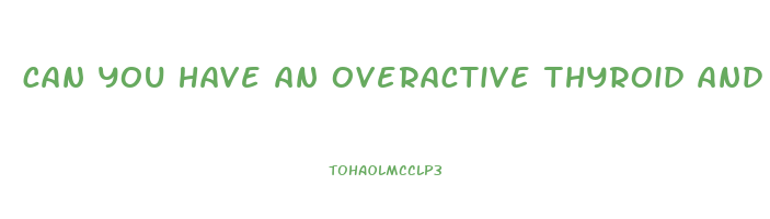 can you have an overactive thyroid and not lose weight