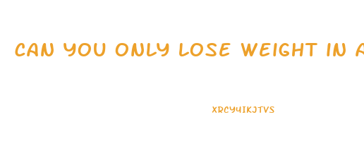can you only lose weight in a calorie deficit