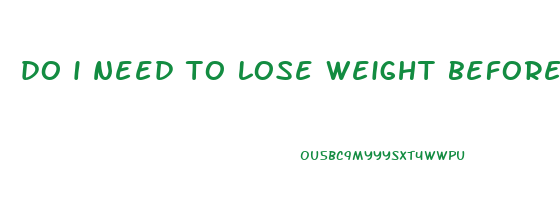 do i need to lose weight before a tummy tuck