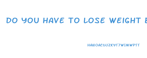 do you have to lose weight before liposuction