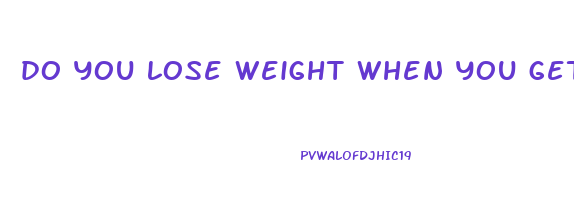 do you lose weight when you get liposuction