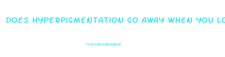 does hyperpigmentation go away when you lose weight