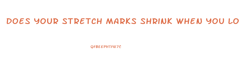 does your stretch marks shrink when you lose weight
